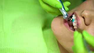 Scaling and polishing in Abu Dhabi