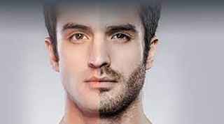 Beard Hair Transplant in Abu Dhabi