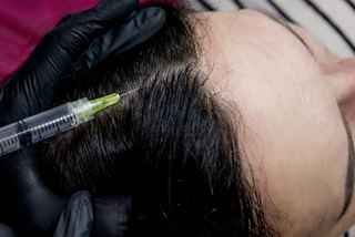 Unlock Your Skin's Potential: Concentrated Growth Factor in Riyadh