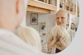 Alopecia areata treatment in Abu Dhabi