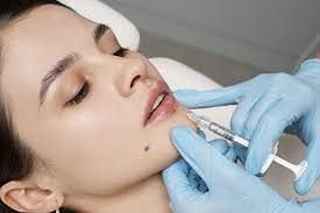 Lip Filler Injection in Dubai