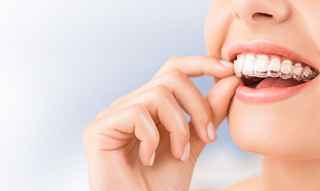Cost of Invisalign
