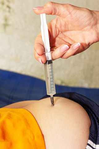 Non-Surgical Arm Fat Removal in Abu Dhabi