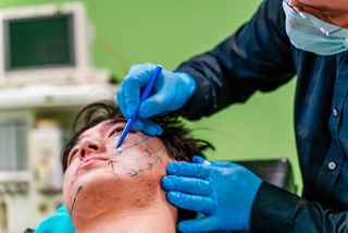 Chin Augmentation Cost in Abu Dhabi
