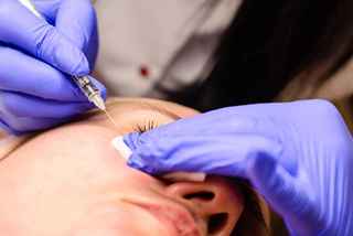Skin Tag Removal in Abu Dhabi