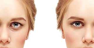 Fat Transfer Surgery in Abu Dhabi