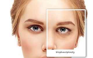 Fat Transfer Surgery in Abu Dhabi