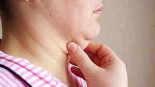 Neck lift surgery in Abu Dhabi