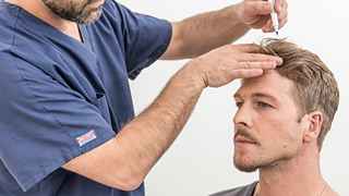Hair Transplant in Riyadh