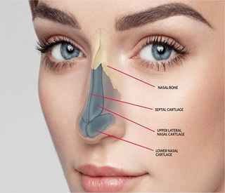 Rhinoplasty in Dubai