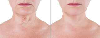 Makeover Cosmetic Surgery in Abu Dhabi