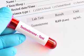 Low testosterone treatments in Abu Dhabi