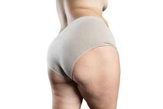 Buttock Augmentation in Abu Dhabi
