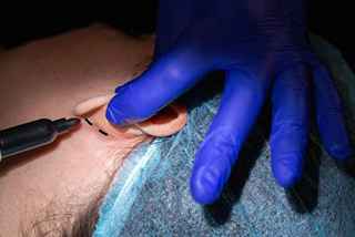 Ear surgery in Abu Dhabi