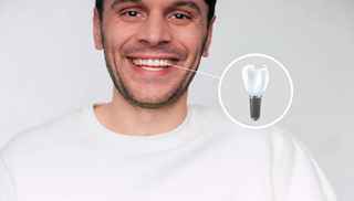 Smile Confidently: Affordable Dental Implants in Riyadh