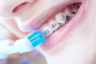 Smile Confidently with Top Orthodontics in Riyadh