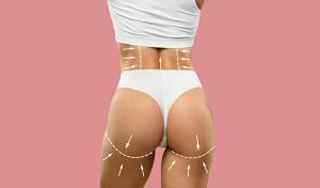 Brazilian Butt Lift Surgery Transform Your Silhouette with Confidence