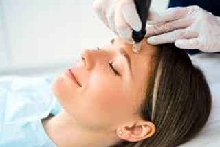 Discovering the Magic of Microneedling 