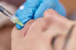 Everything You Need to Know About Lip Augmentation 