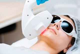 How to Maintain Results After Melasma Treatment