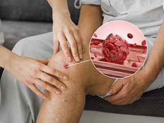 How to Manage Knee Pain from Arthritis