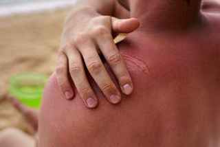 Keloid Treatment What You Need to Know