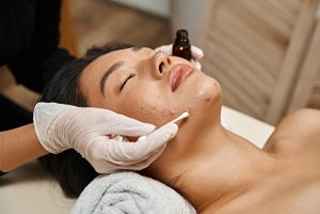Pediatric Pimples Treatment: What You Need to Know