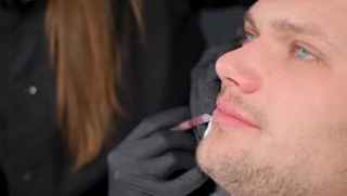 Reasons to Consider Lip Reduction Surgery 