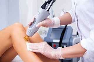 Who Can Benefit from Laser Hair Removal?