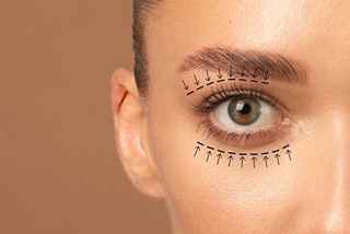 Correct Droopy Eyelids with Surgery