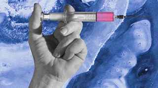Fat-dissolving needles in Dubai