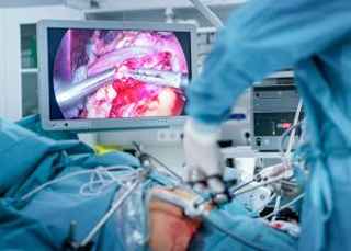 Innovative Weight Loss Bariatric Surgery Techniques 