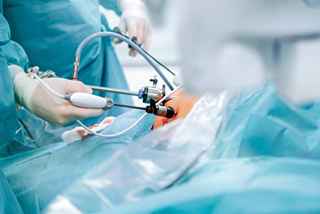 Innovative Weight Loss Bariatric Surgery Techniques