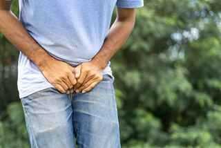 hernia