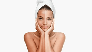 Skin whitening in Islamabad