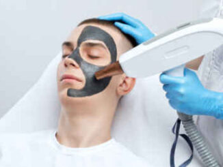 Laser Carbon Peel in Riyadh