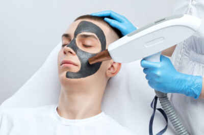 Laser Carbon Peel in Riyadh