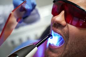 Laser Dentistry: The Modern Approach to Comfortable Dental Care