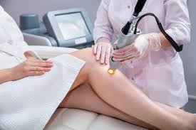 Laser Hair Removal in Dubai